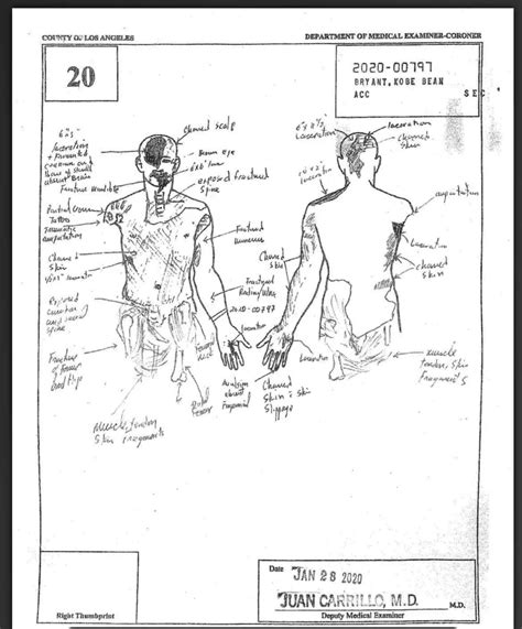 kobe bryant body sketch|Kobe Bryant Autopsy Report